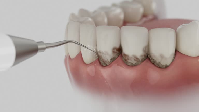 Reliable Dental Implants contractor in Nowthen, MN by Smile Center Dentistry